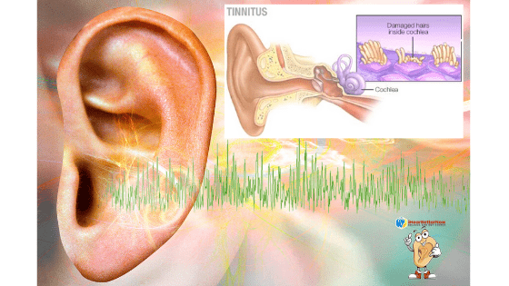 Can Tinnitus be Treated? 3 Can-tinnitus-be-treated